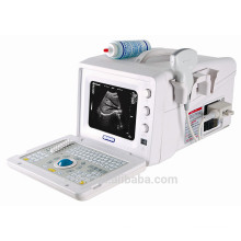 DW-3101A CE approved B/W ultrasound machine